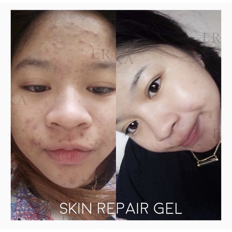 🇹🇭 Erika Skin Repair Gel 42ml / pelembab dan eye cream kulit jerawat / anti acne