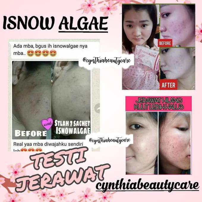 

Terlaris-J685G6688- Isnowalgae Infinesse - Pemutih Kulit - Flek Hitam - Colagen - Jerawat