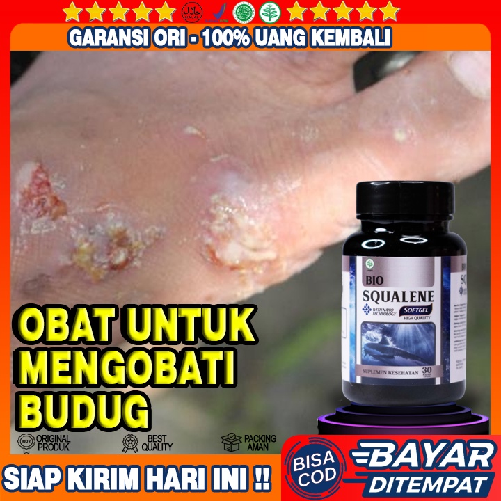 Obat Gatal Budug - Obat Penghilang Bekas Budug - Obat Budug Bernanah - Obat Scabies Manusia - Obat G