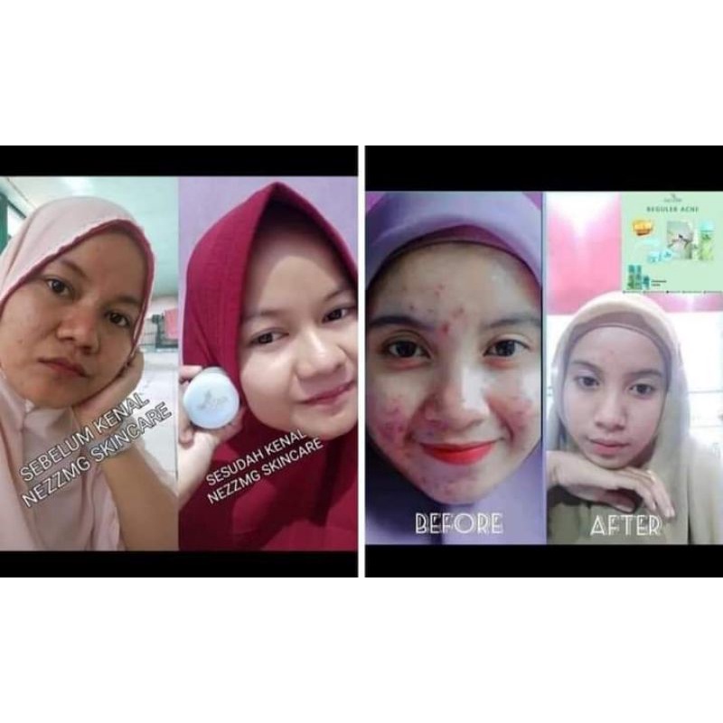 NEZZMG
