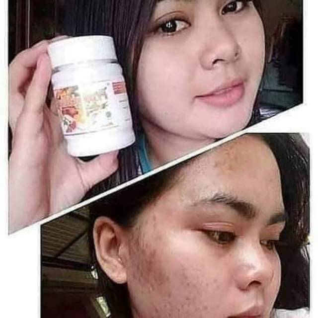 Frutablend Hwi Shopee Indonesia