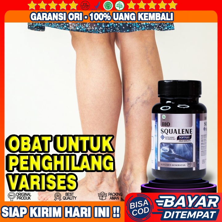 Obat Varises - Obat Varises di Kaki - Obat Alami Varises - Obat Untuk Varises - Obat Varises Bengkak