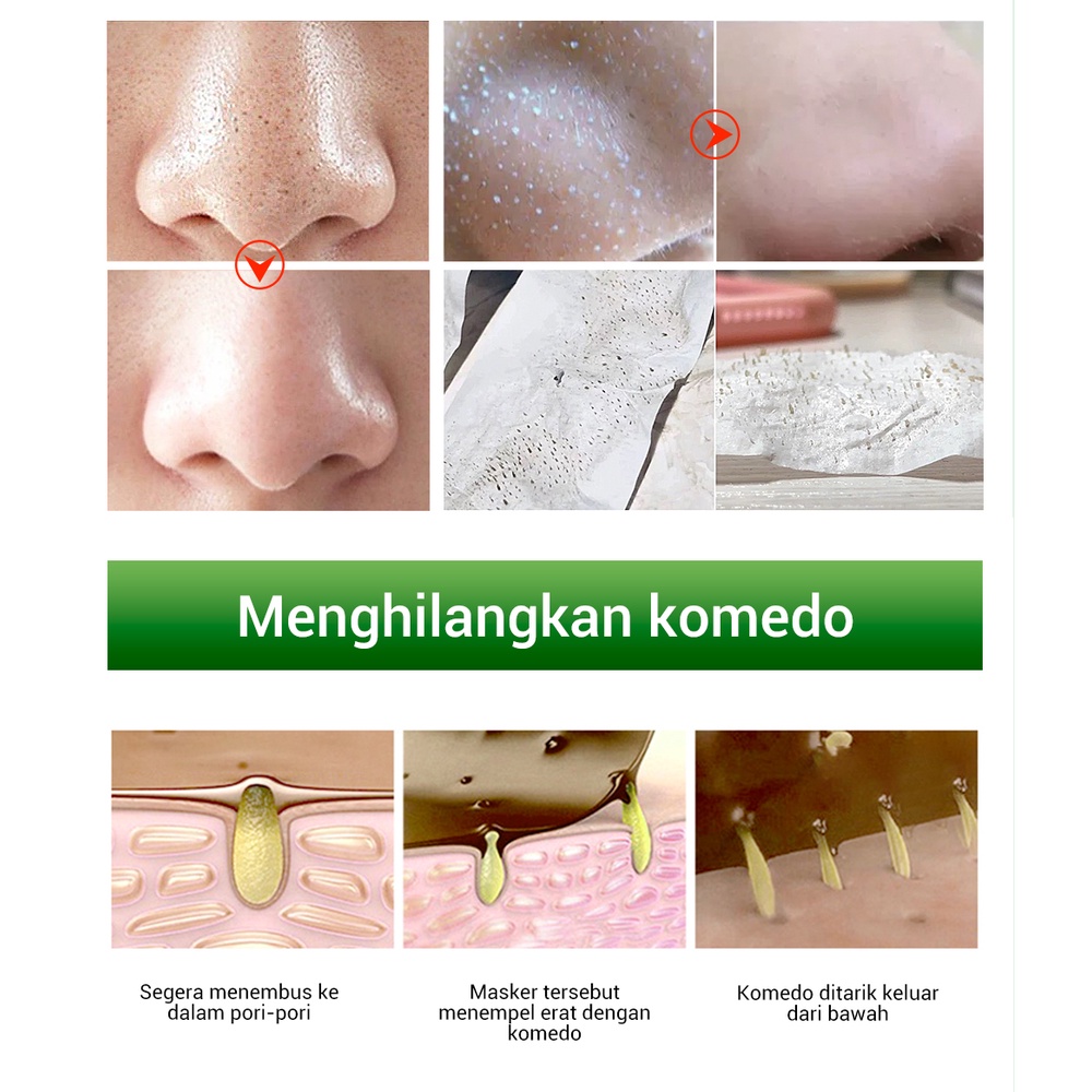 【 BPOM】Allphv masker komedo Varian STEP 1 Pengangkat Komedo penghilang komedo &amp; STEP 2 Pore Serum