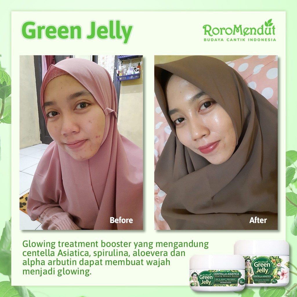 Roro Mendut Green Jelly Sleeping Mask Whitening + Anti Acne Jerawat 15 gr Super Glowing Premium