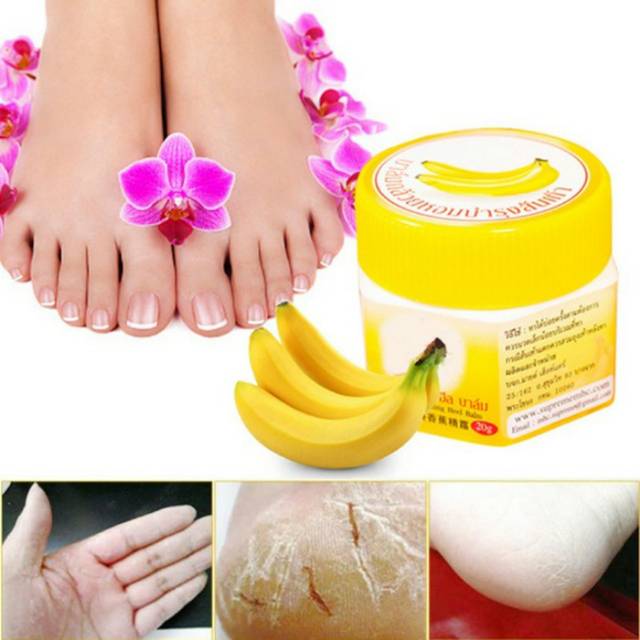 Ready Cream Kaki Pecah Pecah Dengan Cream Kaki