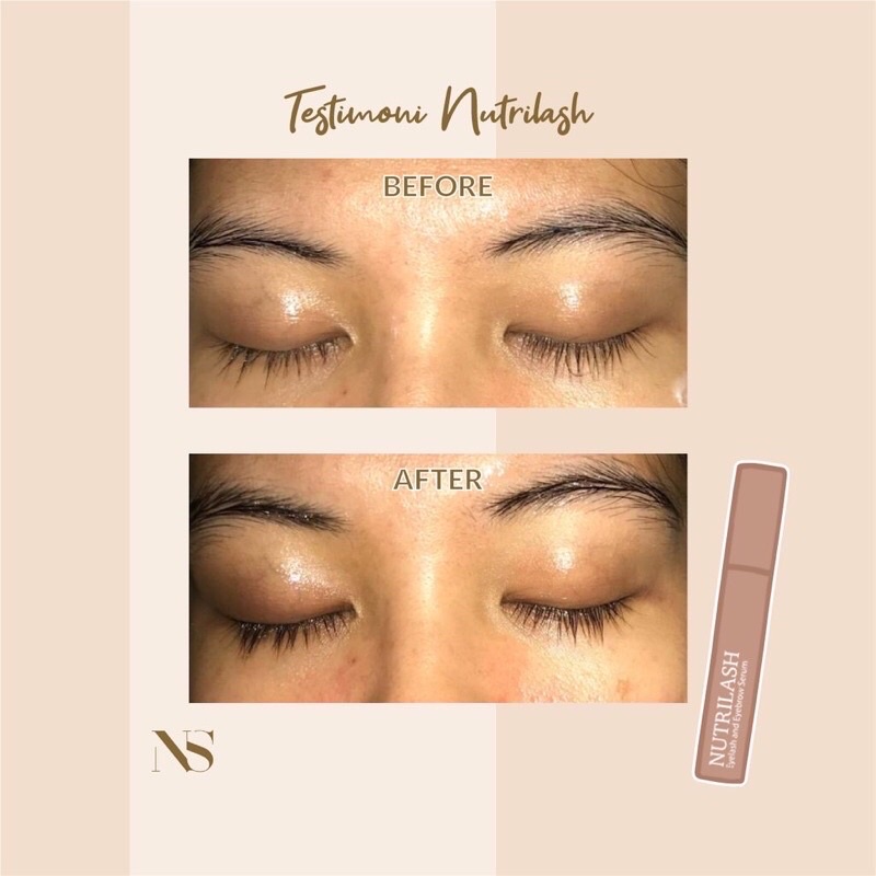 Nutrilash eyebrow dan eyelash serum