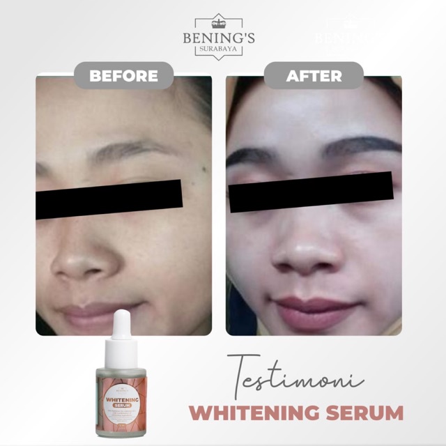 BENING'S SERUM WHITENING | MENCERAHKAN &amp; MENGGLOWINGKAN | BPOM &amp; HALAL