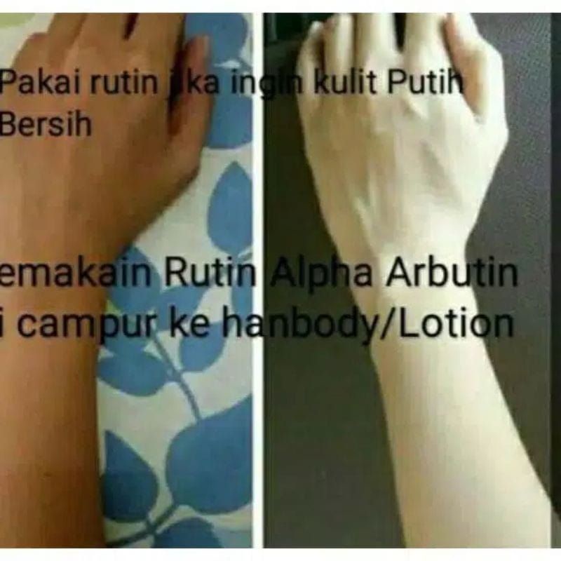 Aschosme BUBUK PEMUTIH ALPHA ARBUTIN Impor