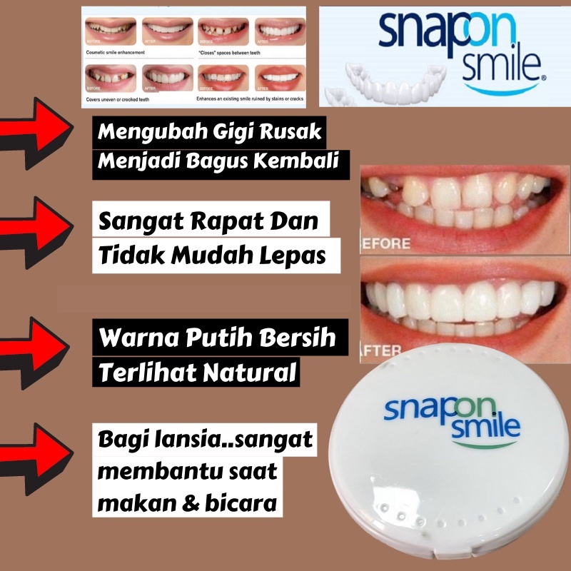 Jual Gigi Palsu Atas Bawah Gigi Palsu Lepas Pasang Veneer Snap On Smile