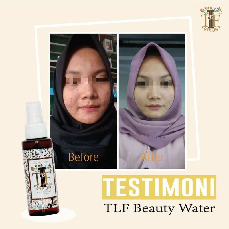 TLF BEAUTY WATER / TLF BEAUTY/ OBAT JERAWAT(FREE PARFUM ROLL ON JIKA TIDAK PROMO)