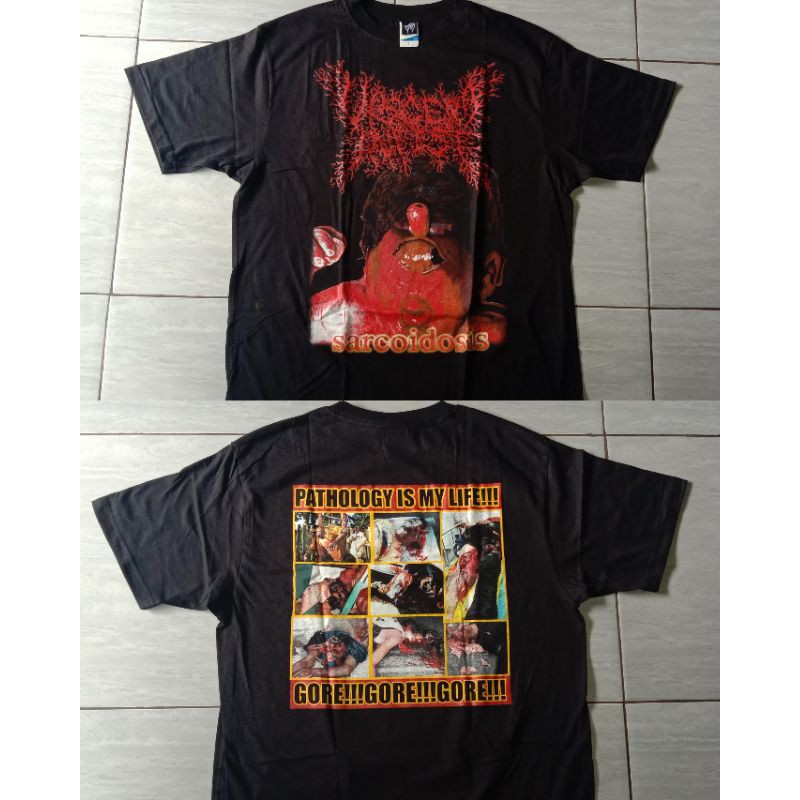 Jual VISCERA INFEST sarcoidosis - TS | Shopee Indonesia