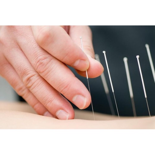 Jarum Akupuntur Hwato Acupuncture Needle isi 100s