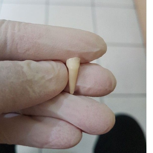 [SULUNG/SUSU] GIGI ASLI MANUSIA SERI / INCISIVUS SUSU / SULUNG / ANAK UNTUK PRAKTIKUM