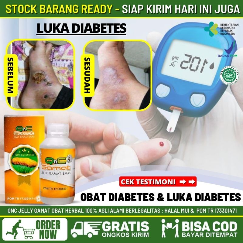 Obat Oles Luka Diabetes Alami, Obat Salep Luka Diabetes, Obat Luka Gangren Diabetes, Obat Luka Basah