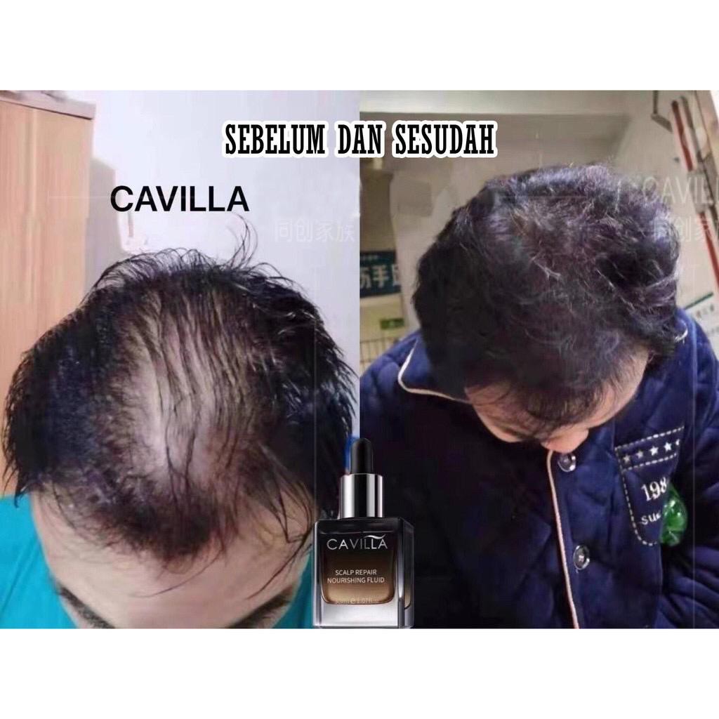 CAVILLA SCALP REPAIR NOURISHING FLUID / SERUM PENUMBUH RAMBUT