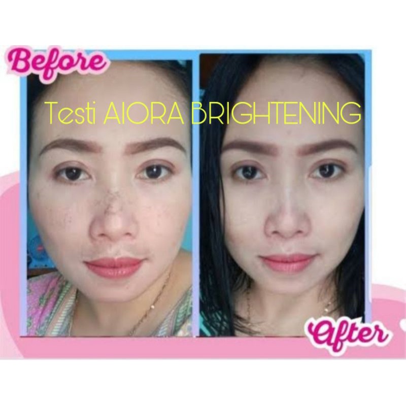 AIORA SKINCARE BPOM CREAM WAJAH PAKET GLOWING ACNE-5