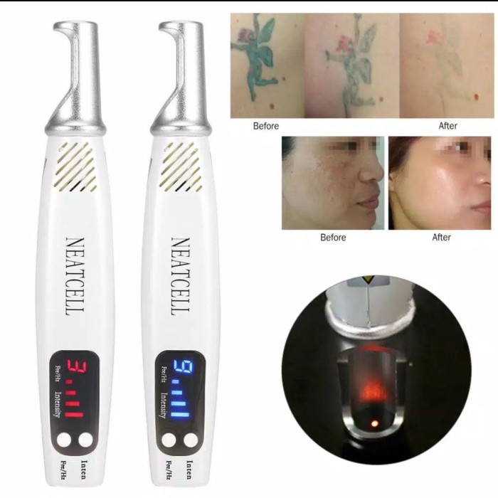 Alat Laser Penghapus Hapus Tatto Penghilang Tato Neatcell