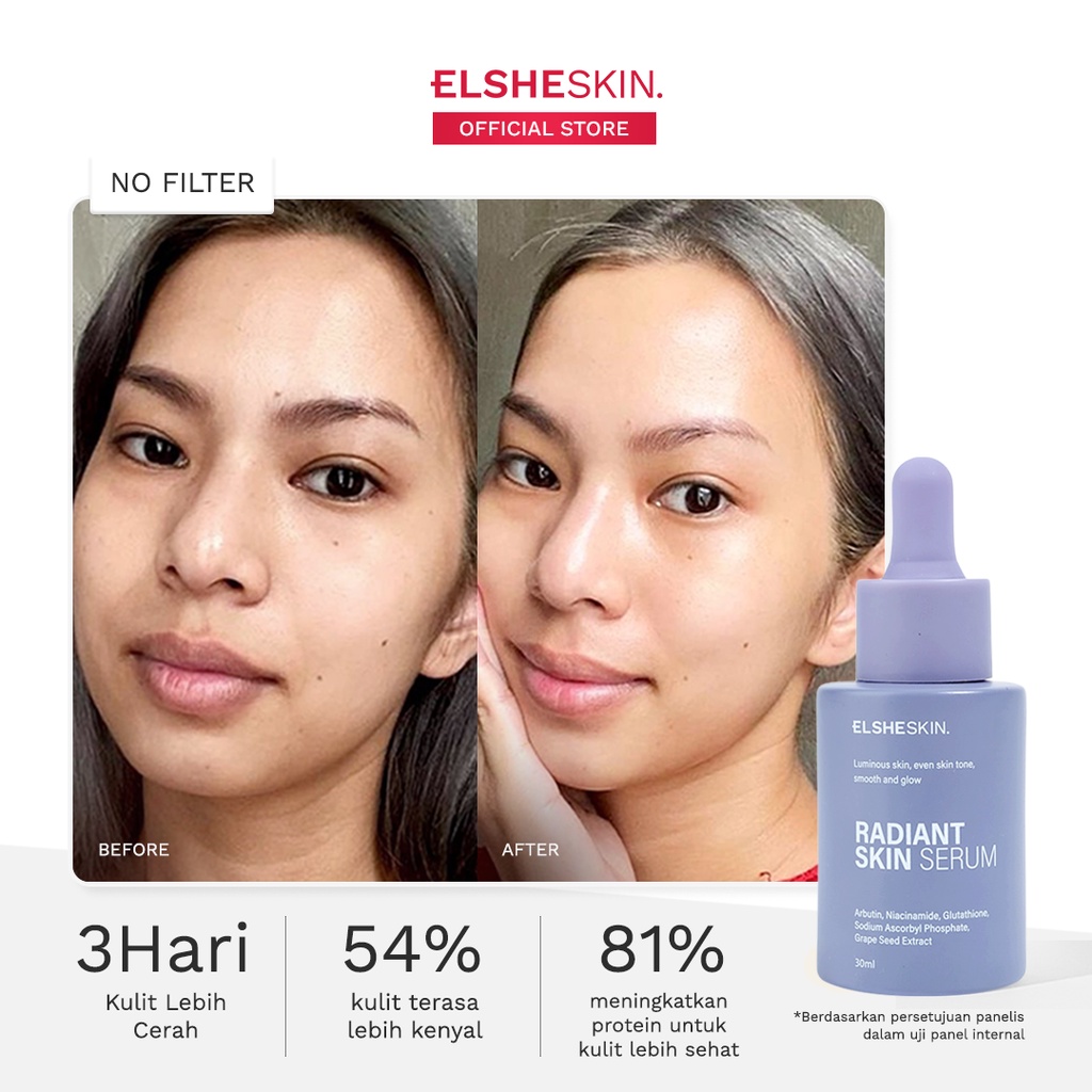 ElsheSkin Radiant Skin Serum - 15/30ml Niacinamide (Cerah, Glowing, Kenyal) - Serum Glowing Image 2