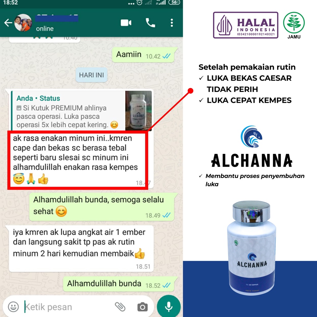 ALCHANNA PREMIUM Ekstrak Ikan Gabus Albumin Kutuk Premium Keringkan Luka Bakar Diabetes Luka Pasca Operasi - Naturafit BPOM