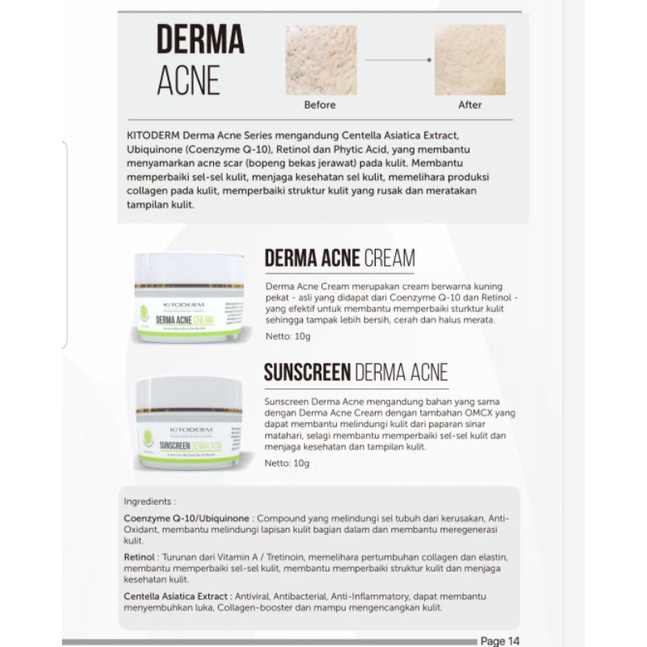 KITODERM DERMA ACNE CREAM