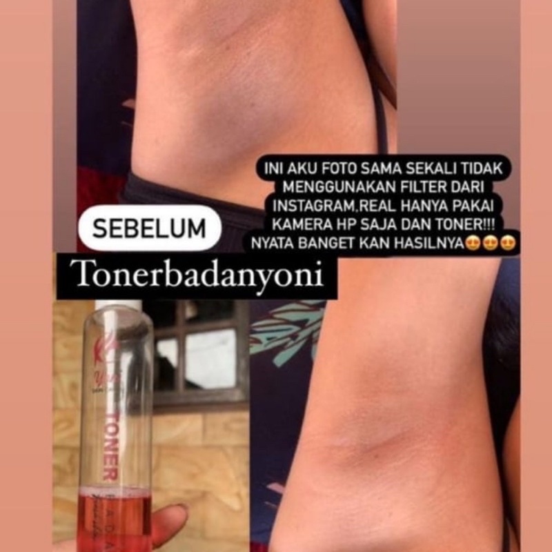✨Up Your Look✨ Toner badan by Yoni 100ml pembersih pencerah badan jerawat punggung back acne