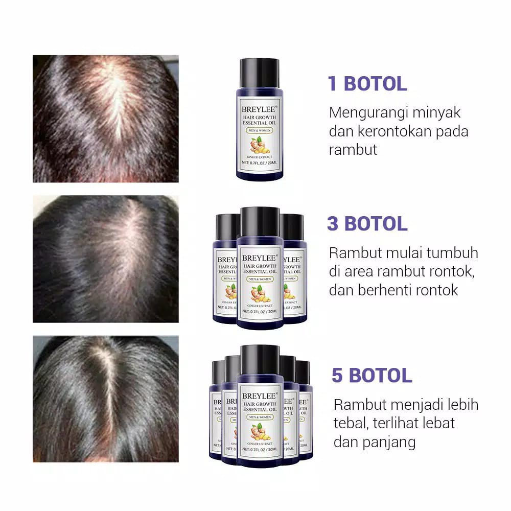 [BPOM] BREYLEE Serum Penumbuh Rambut Breylee Hair Essential Oil Mencegah Rontok Menebalkan Rambut-3