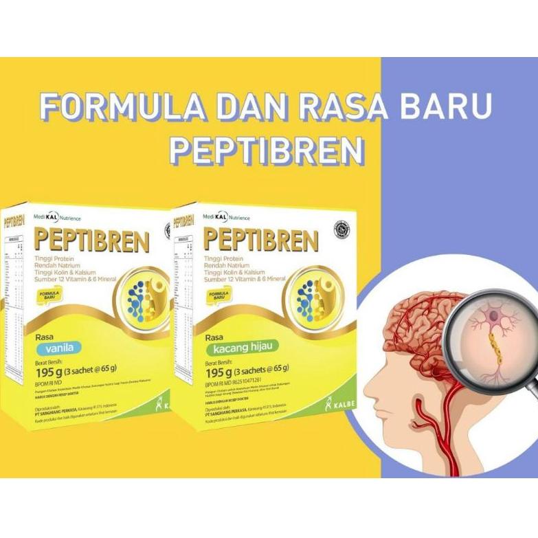 

Bestseller TDZS9 Peptibren V38 Diskon