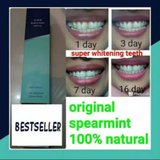super Whitening teeth
