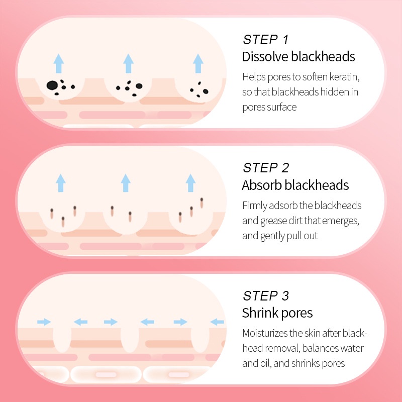 Citadeal - SADOER Masker Komedo Three Steps, Pembersih Komedo, Blackhead Care Mask