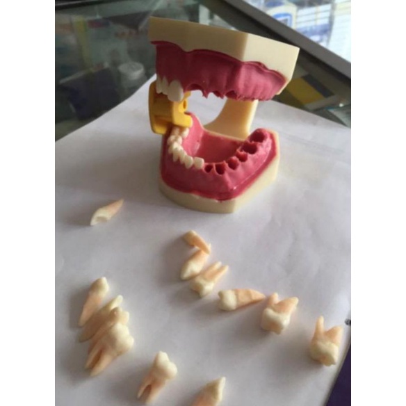 

Model gigi gusi lunak