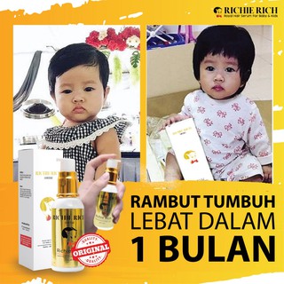  Richie  Rich  Hair Serum Vitamin  Minyak Kemiri Penyubur 