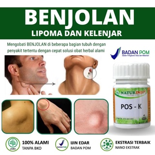 Jual Obat Lipoma Benjolan Uci Uci Benjolan Ketiak Tangan Tubuh Benjolan ...