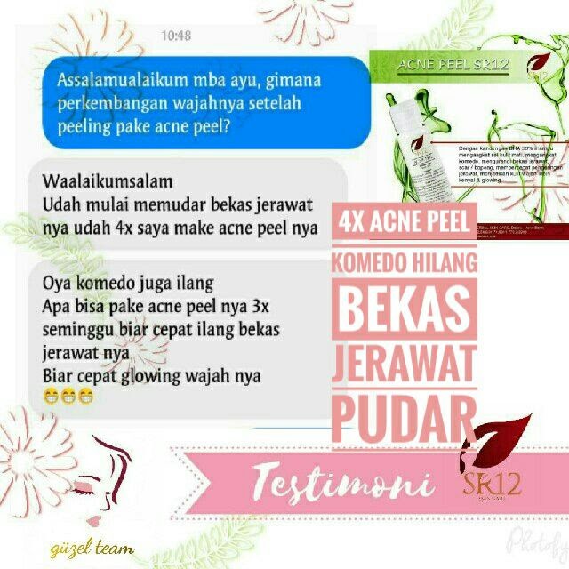 SR12 Acne Peel - Perawatan dan Pembersih Jerawat Untuk Muka Wajah - SR12 Skincae - Skin Care