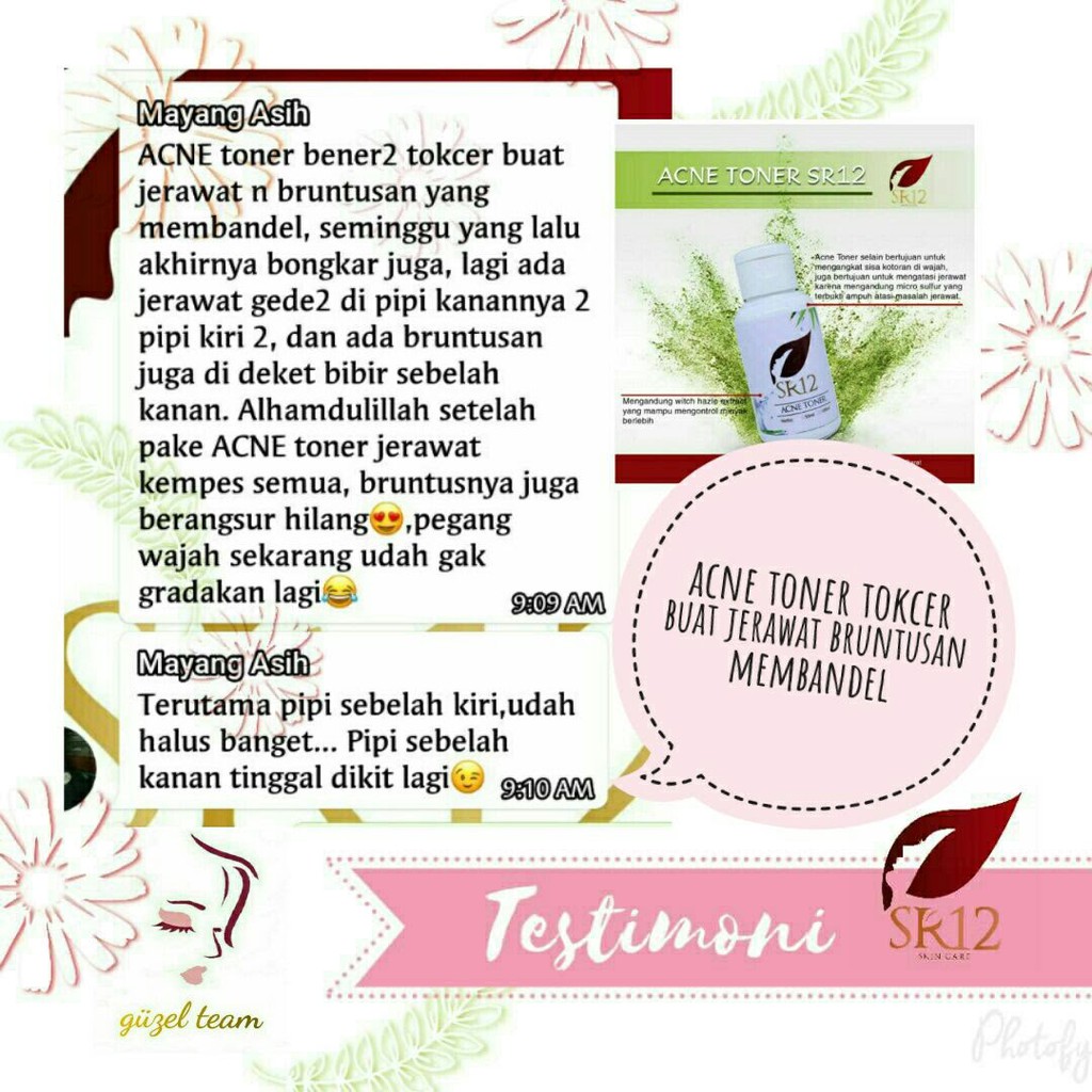 SR12 Acne Toner - Perawatan dan Pembersih Jerawat Untuk Muka Wajah - SR12 Skincare - Skin Care