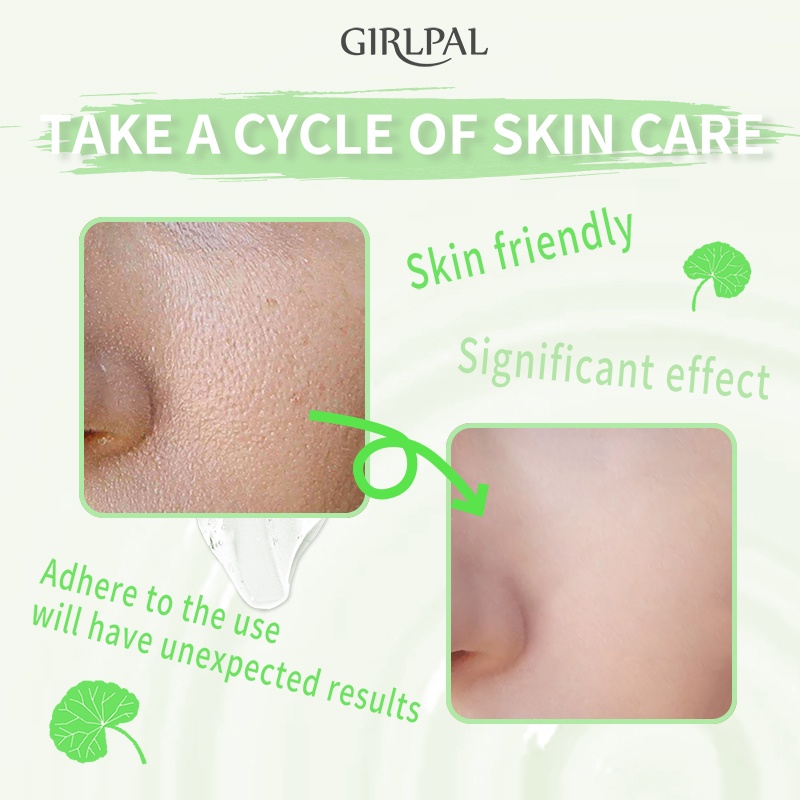 [Trending viral] GIRLPAL CENTELLA ASIATICA PEELING GEL ISI 100 GRAM BPOM