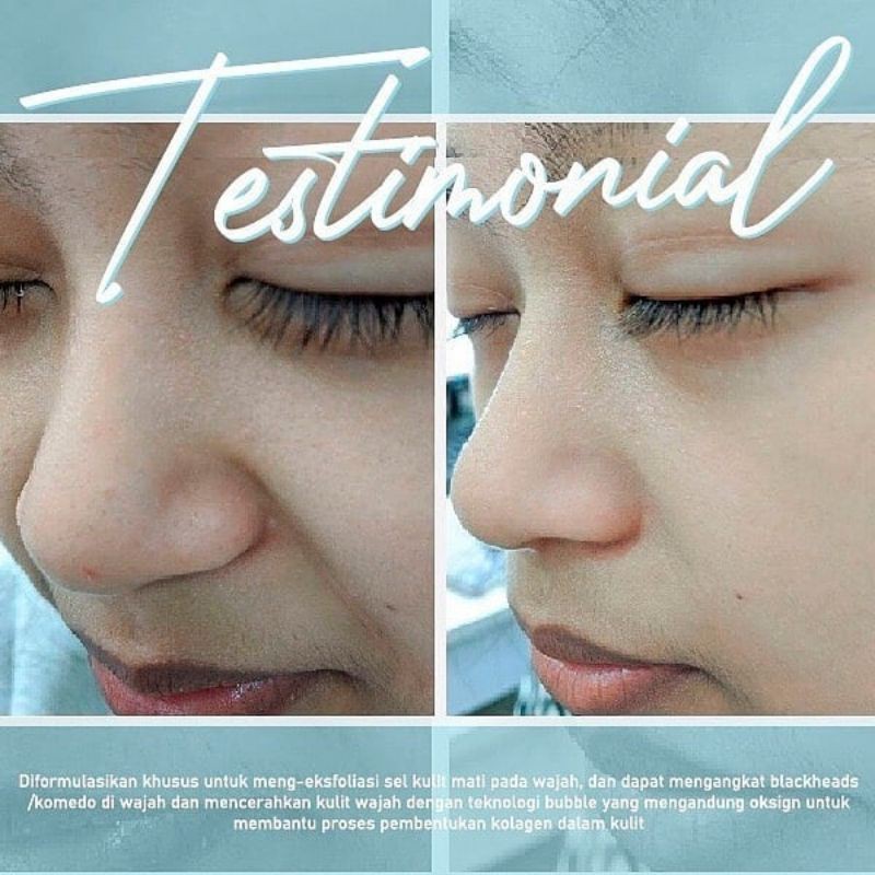 Face Peel Scrub Pengangkat Sel Kulit Mati Wajah Shopee Indonesia