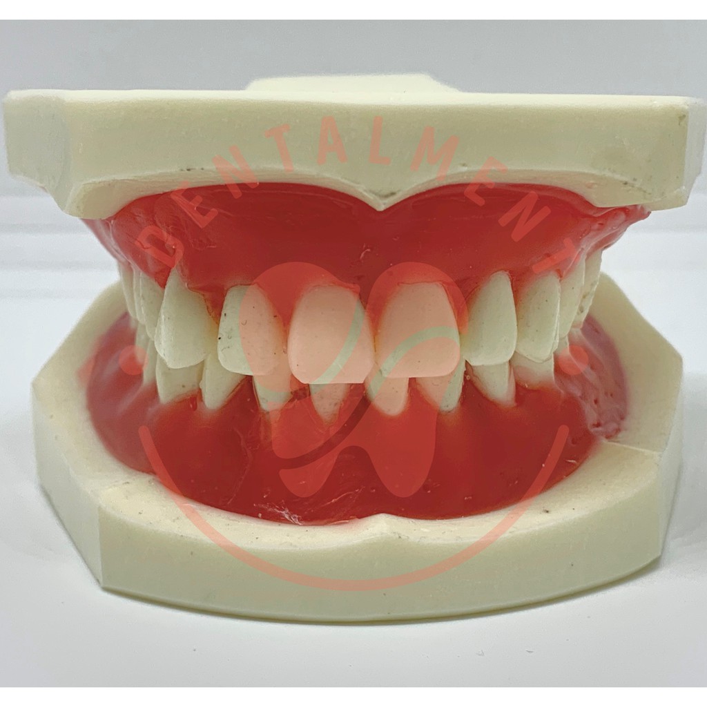 Typodont Model Ortho Malam / Typodont Phantom Orthodontic / Model Gigi