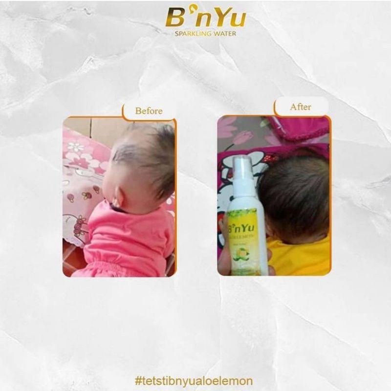 B'NYU Aloelemon hair tonic 60ML