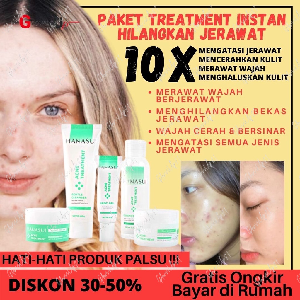 PENGHILANG JERAWAT HANASUI ACNE TREATMENT PAKET 5IN1 ORIGINAL BPOM CREAM ACNE HANASUI CREAM BEKAS JERAWAT KRIM JERAWAT SKINCARE ACNE PERAWATAN JERAWAT