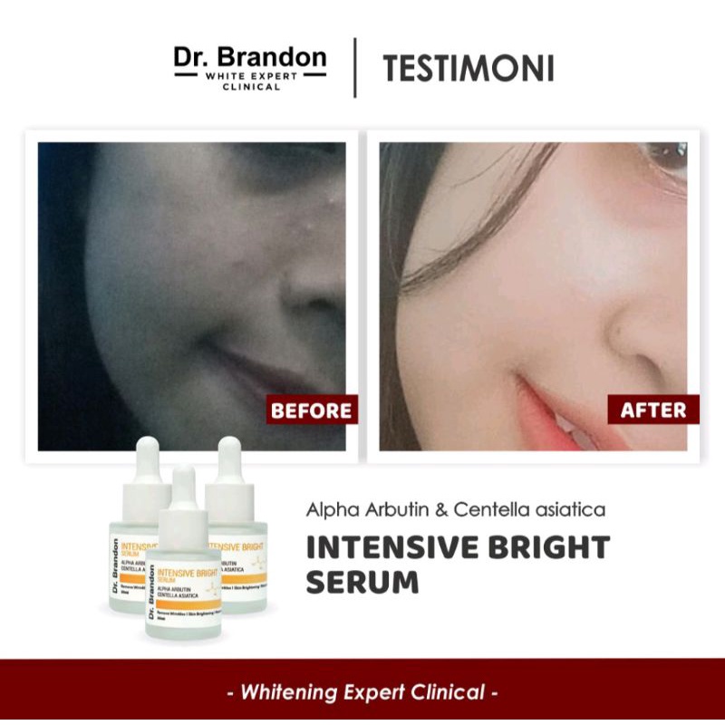 Dr.brandon Intensive Bright Alpha Arbutin+Cantella Asiatica Serum 20ml