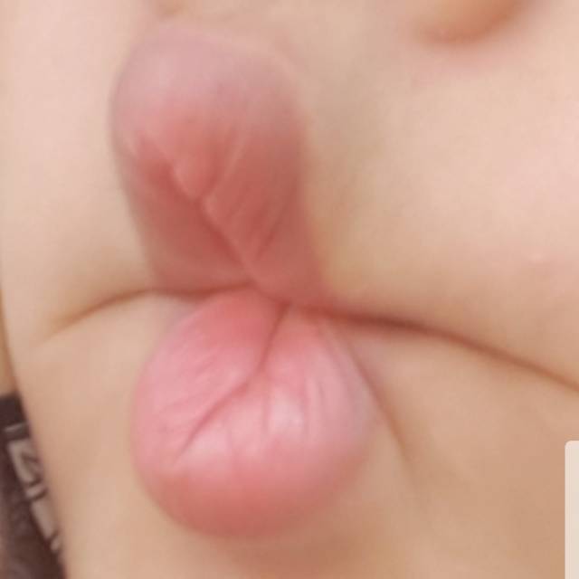aniskurliy