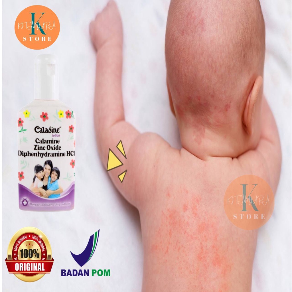 Caladine lotion Calamine Zinc Oxide Diphenhydramine HCI 60ml Obat Gatal Cair CALADINE LOTION 60 ML BEDAK ANTISEPTIK GATAL ALERGI BIANG KERINGAT Obat Gatal Biang Keringat Anak Bayi