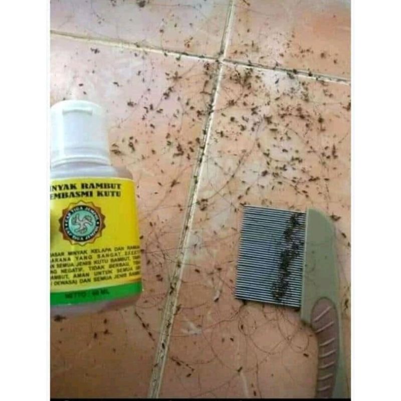 OBAT KUTU RAMBUT AMPUH BUKAN PEDITOX