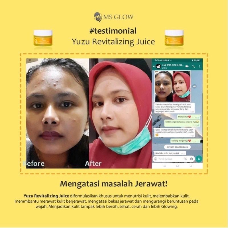 BISA COD HYDRATING JUICE MS GLOW MOISTURIZER _ MS GLOW JUICE MOISTURIZER YUZU MOISTURIZER CACTUS MOISTURIZER