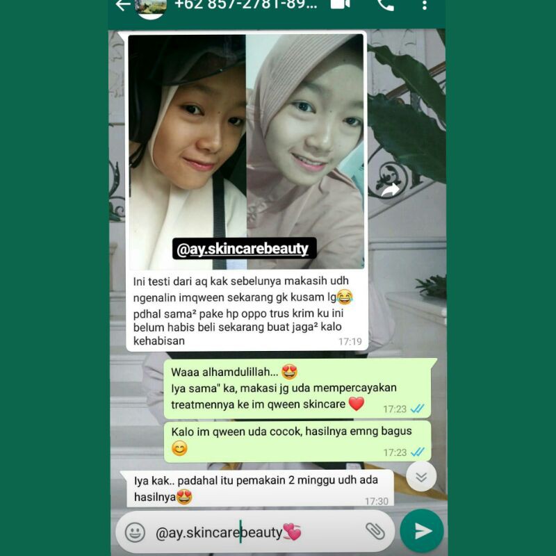 IM QWEEN SKINCARE PAKET ACNE (kulit berminyak & berjerawat)