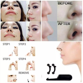 Image of thu nhỏ [ORI] Alat Pemancung Hidung Instan Tanpa Operasi & Nyaman digunakan Tidak Mengganggu Siklus Pernapasan | Secret Nose 3D Original Korea #6