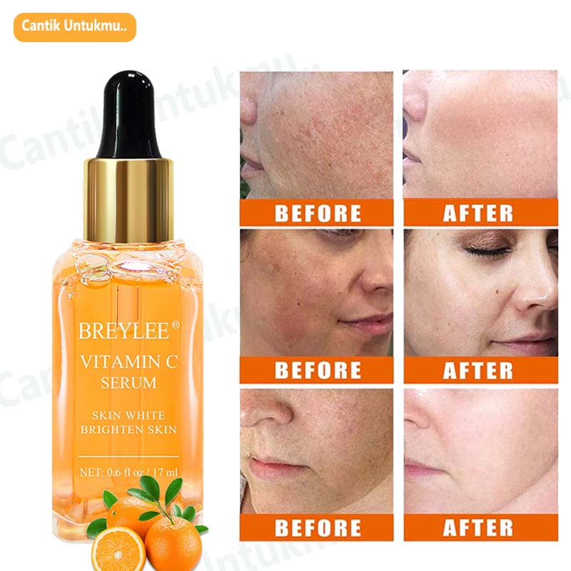 Serum Breylee Vitamin C / Retinol /Acne Treatment /Step 1 dan 2 Original 100%/ - Pemutih Pelembab Wajah Facial Serum &amp; Essence