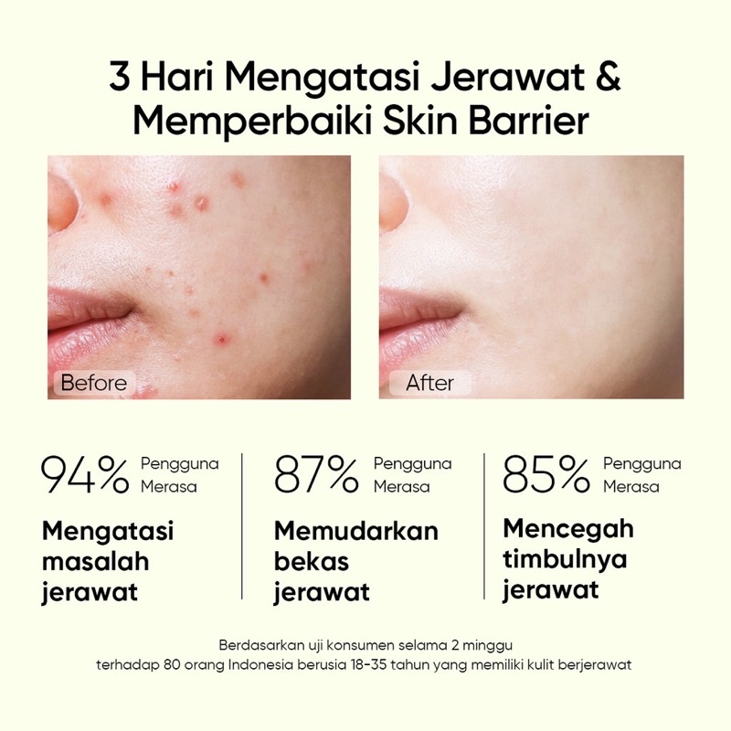 SKINTIFIC - Anti Acne Serum Acne Spot Treatment Facial Gel with 2% Salicylic Acid Brightening Face Serum for Repair Skin Barrier