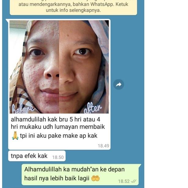 ♧ ADERA FACE SERUM ORIGINAL SERUM ADERA WAJAH ORI UNTUK FLEK HITAM GLOWING ORI ASLI 100% ♙