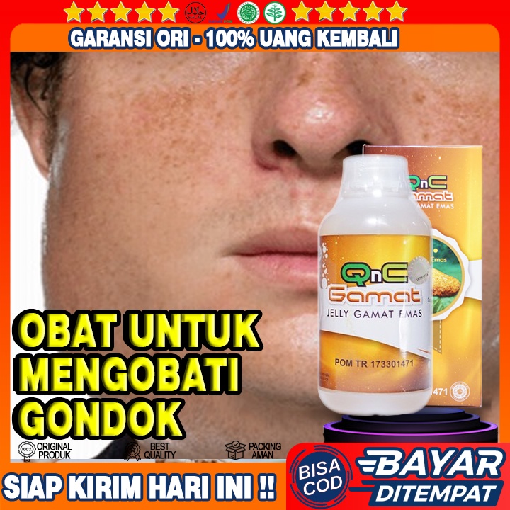 Obat gondok, Benjolan Tiroid, Benjolan Di leher Di Tangan, Benjolan Lipoma, Benjolan Di Jidat, Bisul